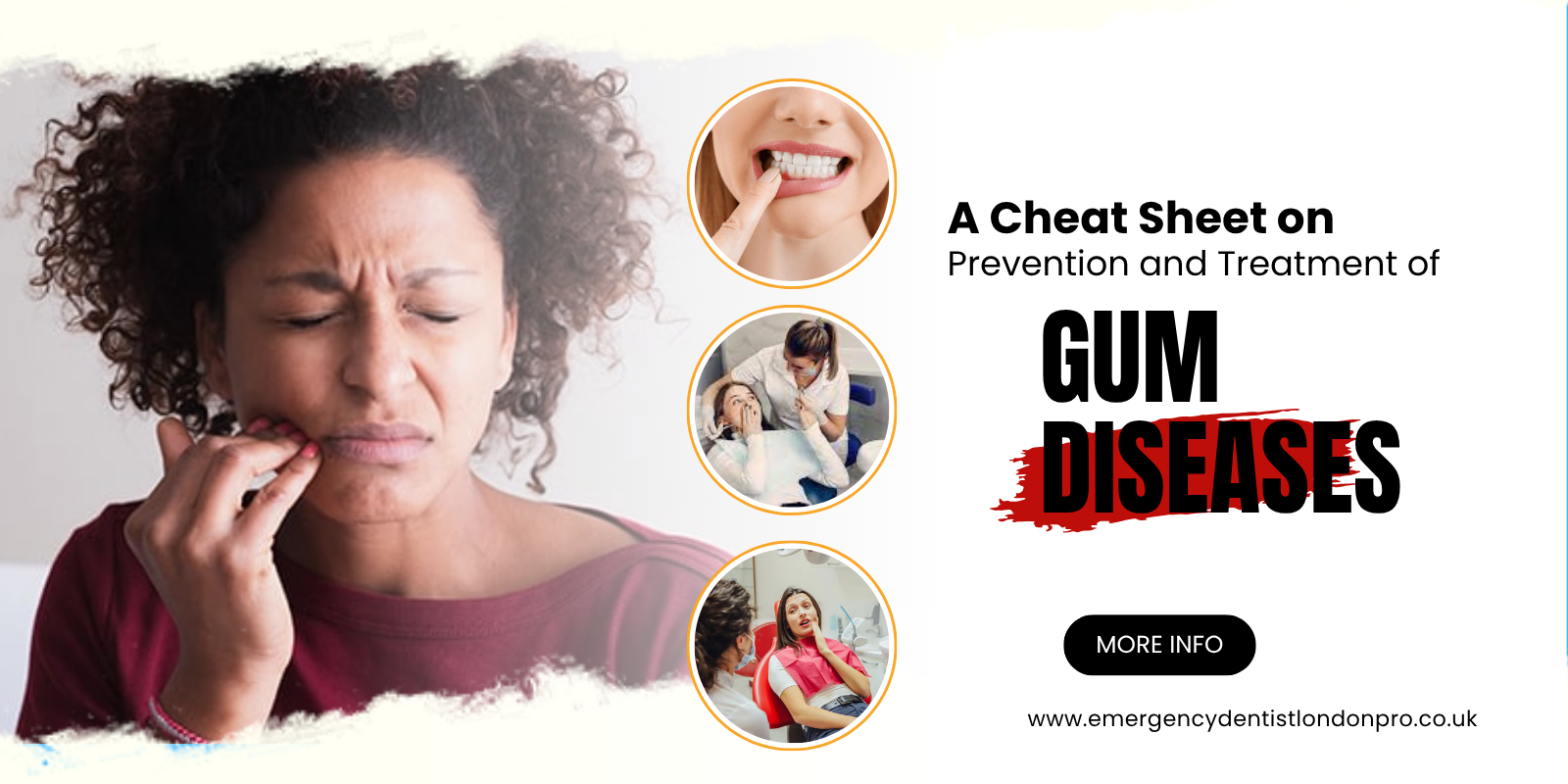 A Cheat Sheet on Prevention and Treatment of Gum Diseases