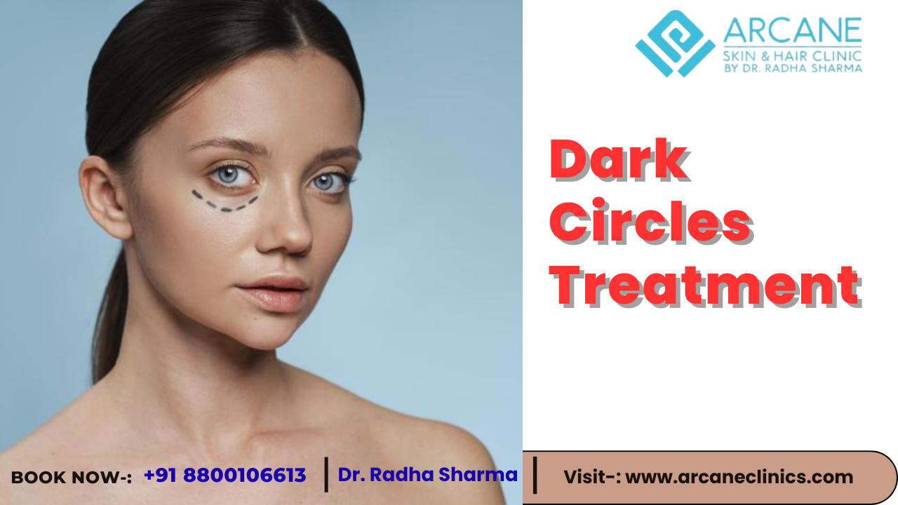 Dark Circles Treatment