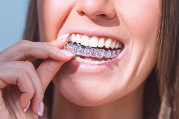 orthodontist Mansfield