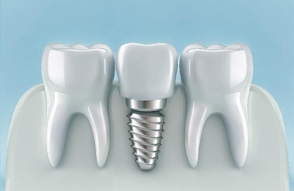 Dental Appointment