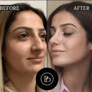 Why People Trust the Best Plastic Surgeons in Dubai