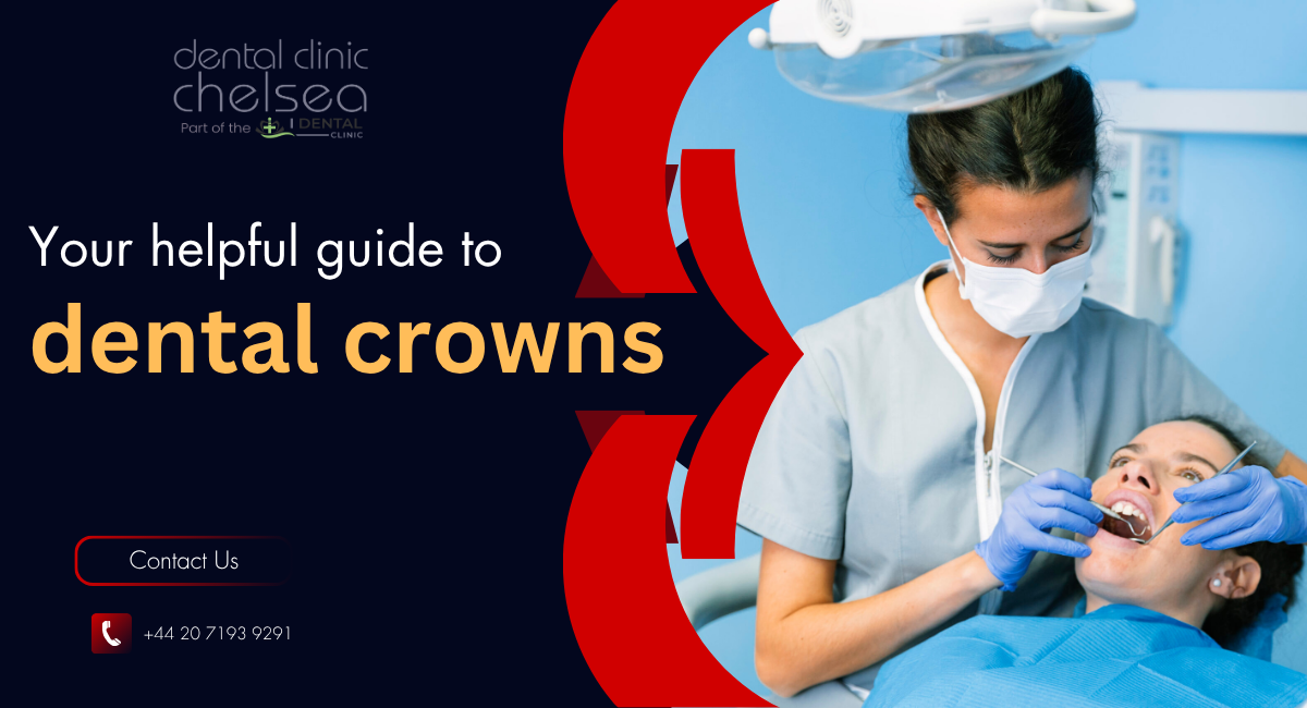 dental crowns in London