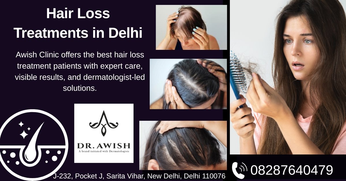 best Hair loss Treatment