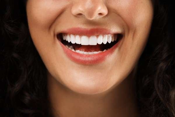 Teeth Whitening Swansea