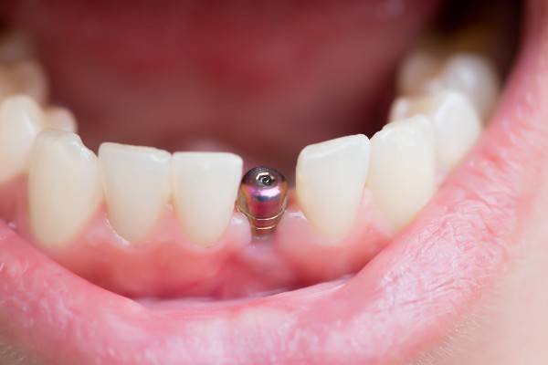 Hygienist in Walsall