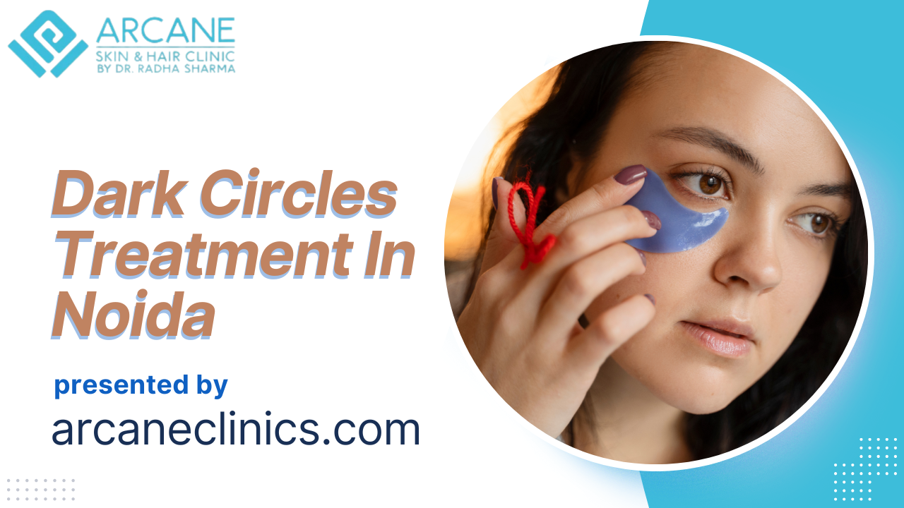 Dark Circles Treatment In Noida