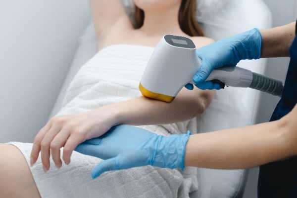 laser hair removal in Preston
