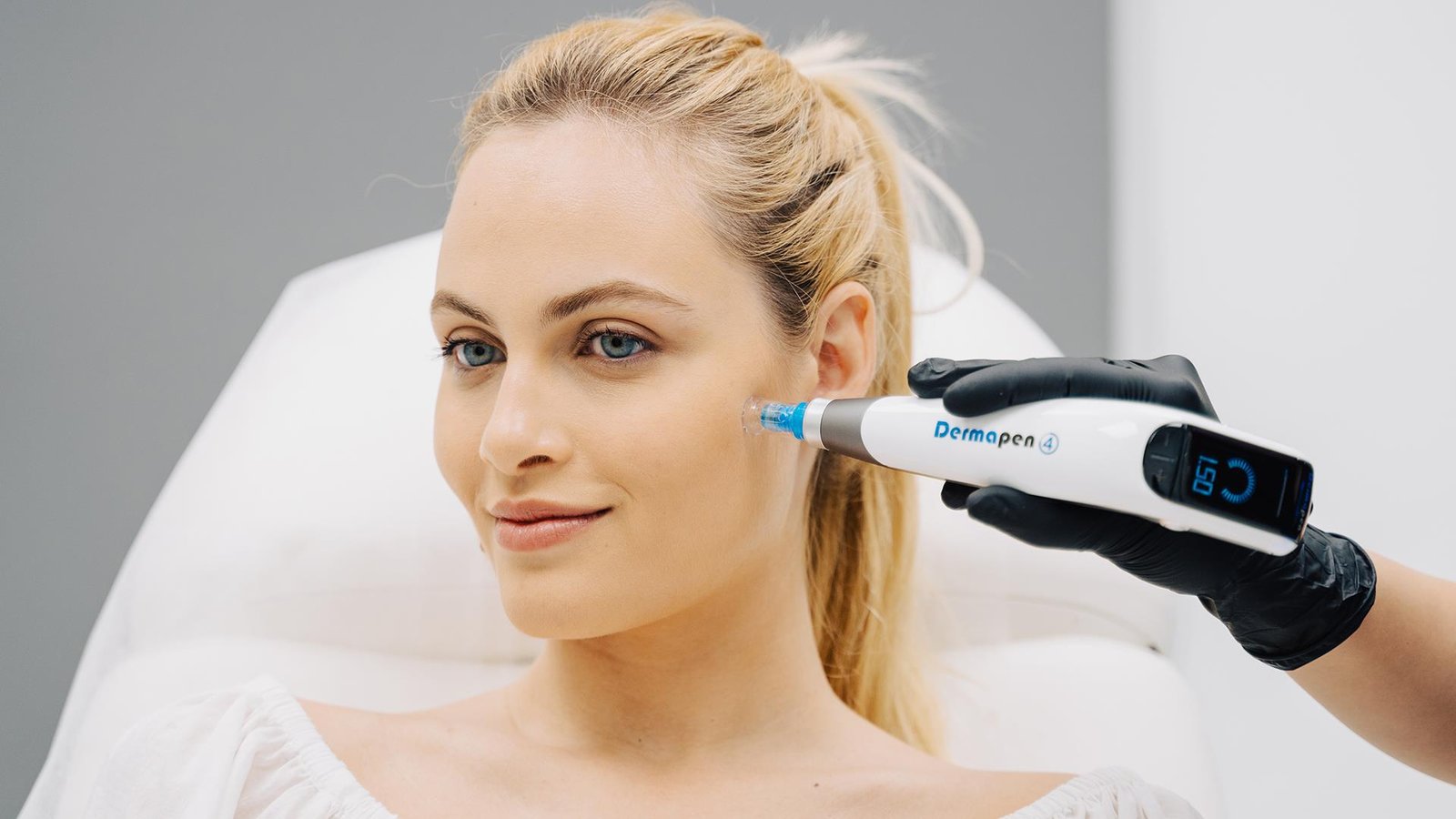 What Happens During a Dermapen Treatment Session?